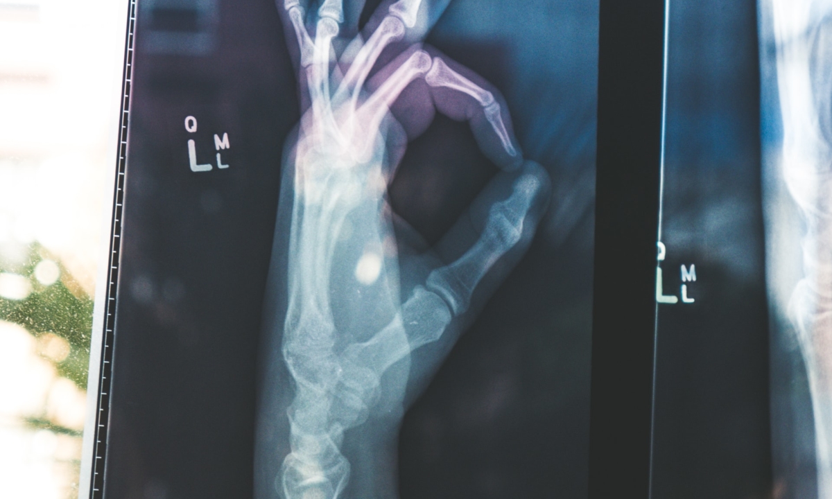 Radiography / hand